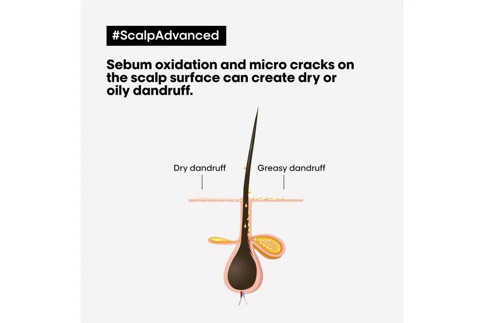 L'Oréal Professionnel Scalp Advanced Anti - Dandruff Shampoo 300ml - shelley and co
