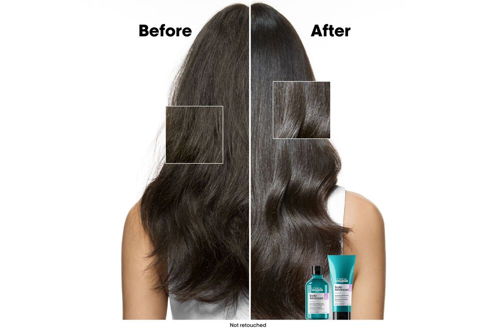 L'Oréal Professionnel Scalp Advanced Anti - Discomfort Shampoo 300ml - shelley and co