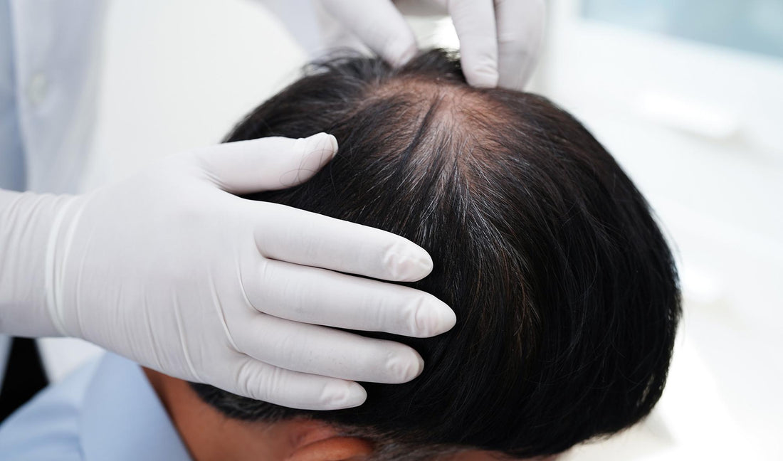 Hair Loss Solutions That Actually Work - Shelley and Co
