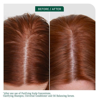 Biolage Scalp Sync Clarifying Shampoo 400ml