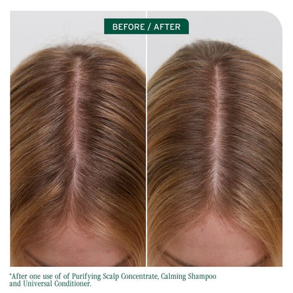 Biolage Scalp Sync Universal Conditioner 236ml