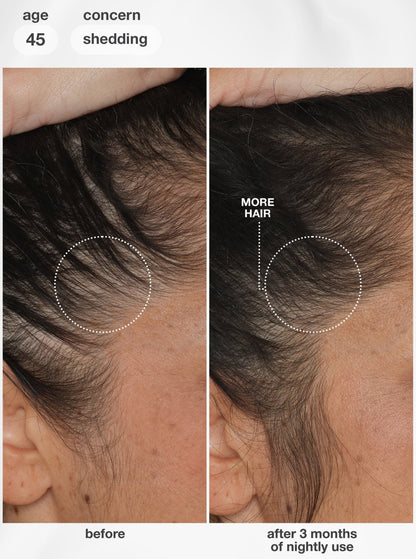 K18 FutureIQ™ Biomimetic Hair Longevity Serum 90ml - Shelley and Co