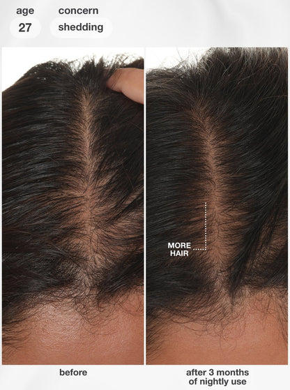 K18 FutureIQ™ Biomimetic Hair Longevity Serum 90ml - Shelley and Co