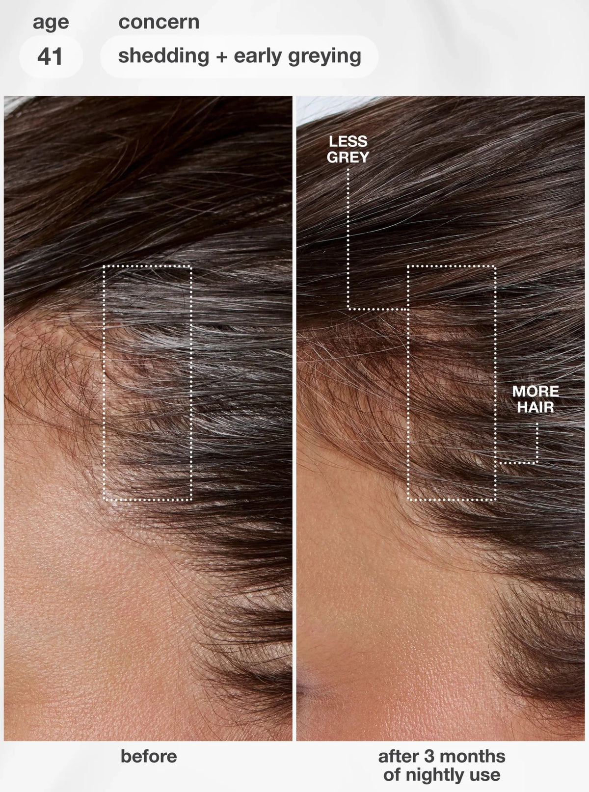 K18 FutureIQ™ Biomimetic Hair Longevity Serum 90ml - Shelley and Co