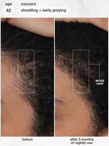 K18 FutureIQ™ Biomimetic Hair Longevity Serum 90ml - Shelley and Co
