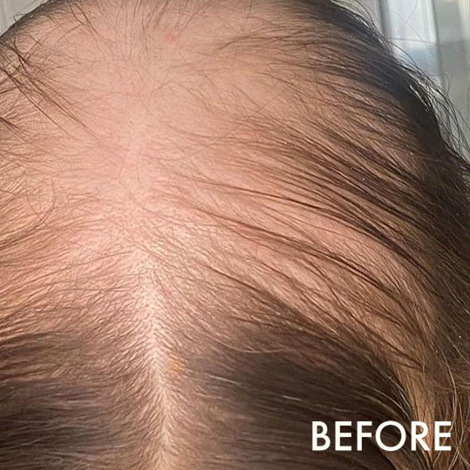 La Biosthetique Méthode Régénérante Hairloss Control Scalp Concentrate (10 x 10ml) - shelley and co