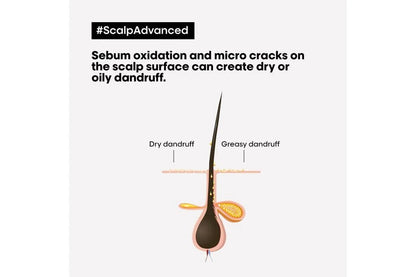 L'Oréal Professionnel Scalp Advanced Anti - Dandruff Shampoo 300ml - shelley and co