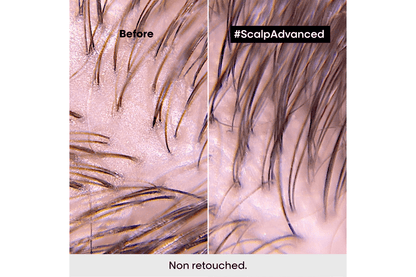L'Oréal Professionnel Scalp Advanced Anti - Oiliness Mask 250ml - shelley and co